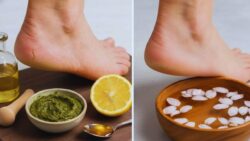 Quick Ways to Heal Dry Cracked Heels at Home Using Safe Kitchen Ingredients