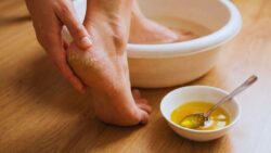Fast Healing Remedy for Dry Cracked Heels Using Simple Kitchen Ingredients at Home